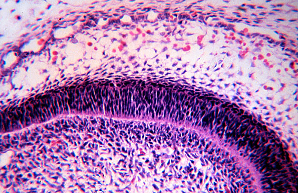  fetal rat, developing tooth, ameloblasts and odontoblasts 