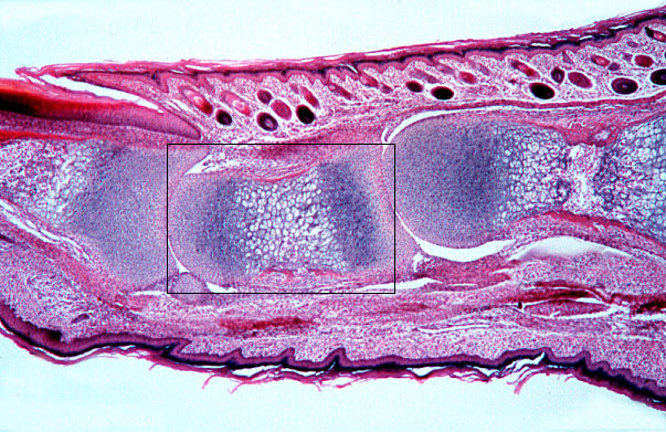  endochondral ossification, primary center 