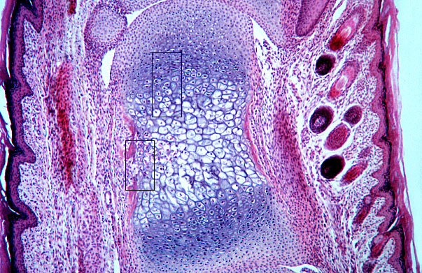  endochondral ossification, primary center 