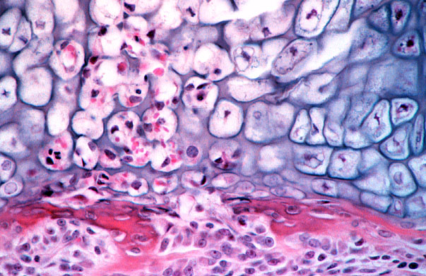  endochondral ossification, primary center 