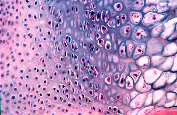  endochondral ossification, primary center 
