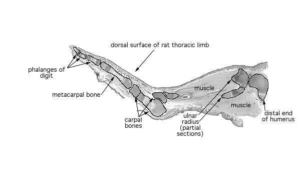  developing long bone, primary center 