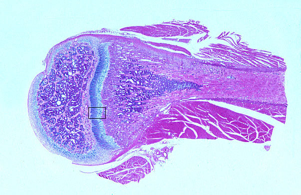  endochondral ossification, secondary center and epiphyseal plate; bone modeling 