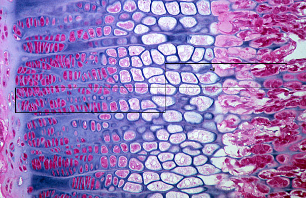 endochondral ossification histology