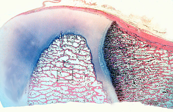  trabecular, woven and lamellar bone 