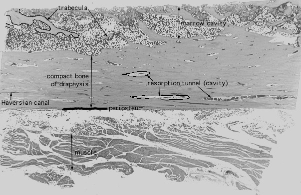  bone remodeling 