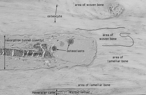  bone remodeling 
