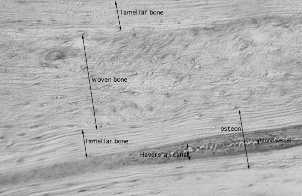  bone remodeling 