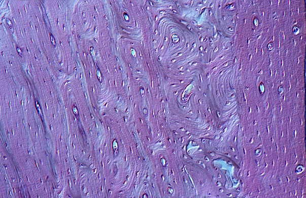  compact, woven and lamellar bone 