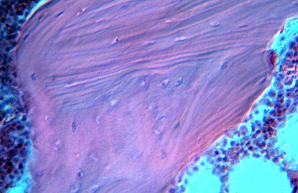 trabecular, woven and lamellar bone 