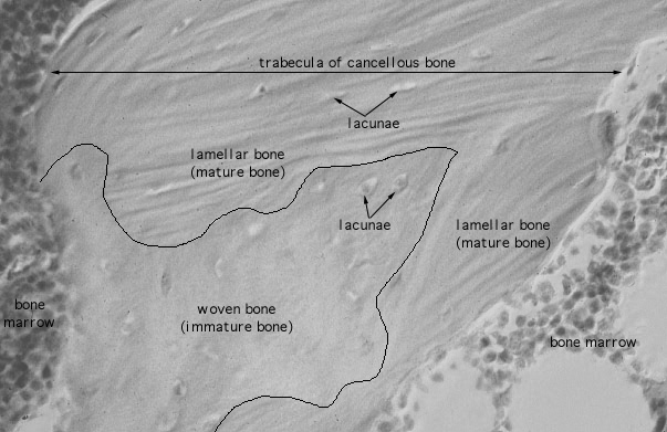  trabecular, woven and lamellar bone 