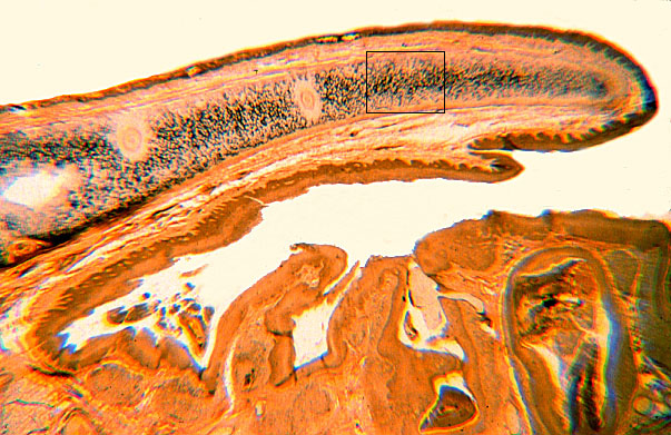  elastic cartilage, elastic fibers 