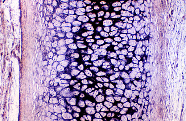  elastic cartilage, elastic fibers 