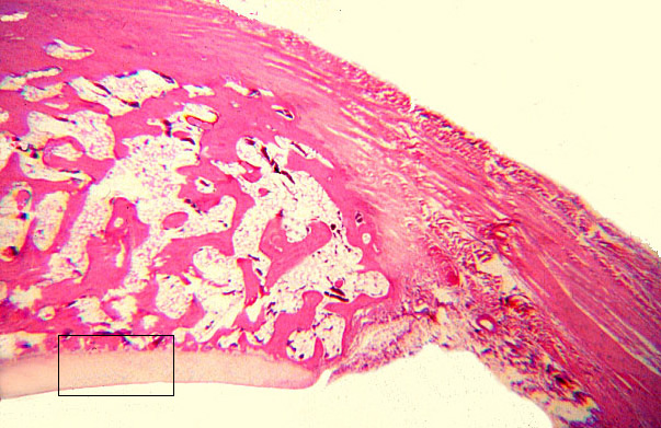  articular cartilage 