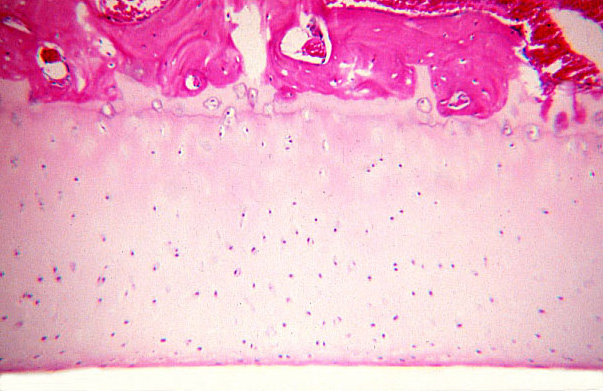  articular cartilage 
