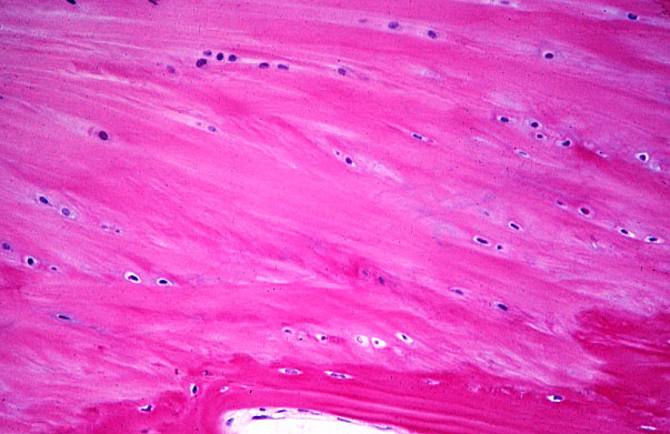  fibrocartilage 