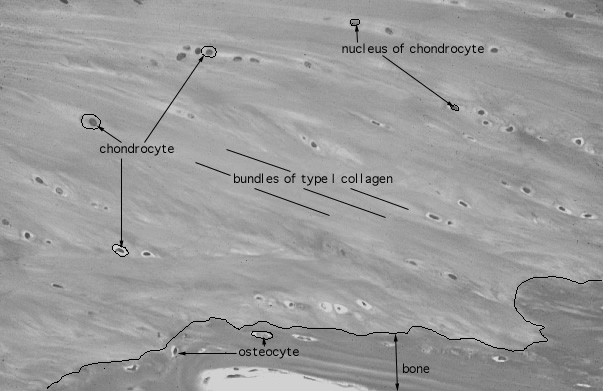  fibrocartilage 