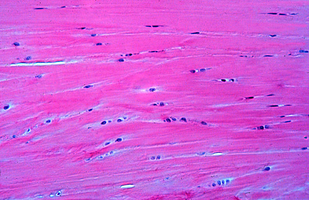  fibrocartilage 