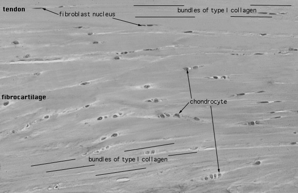  fibrocartilage 