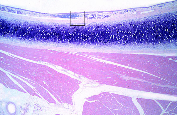  diffuse lymphoid tissue 