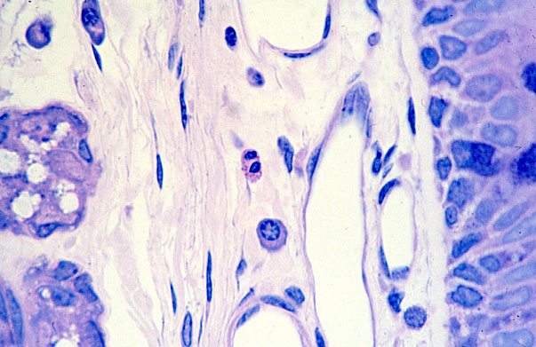  lamina propria, plasma cells, fibroblasts 