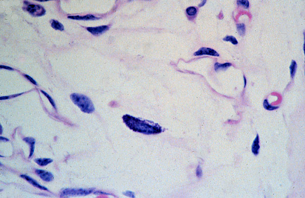  lamina propria, mast cells, metachromatic cytoplasmic granules 