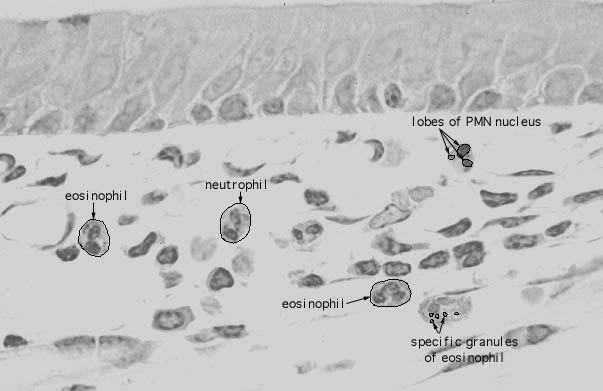  lamina propria, eosinophils and neutrophils 