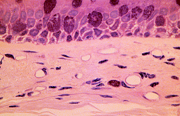  lamina propria, collagen 
