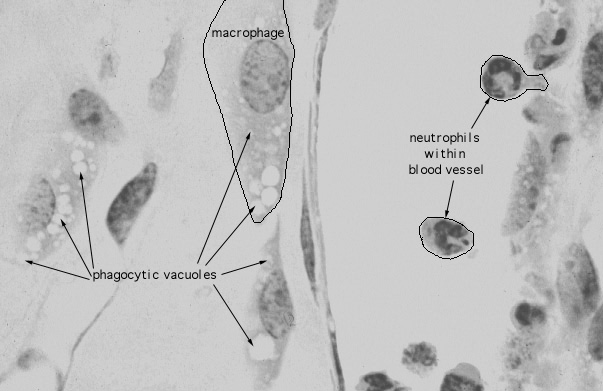 lamina propria, macrophages and neutrophils 