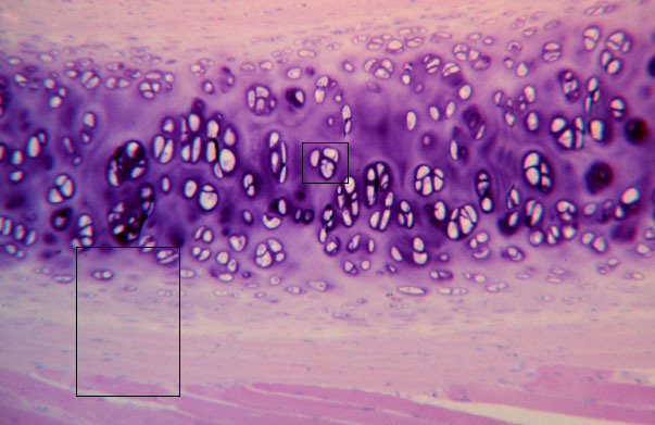  hyaline cartilage 