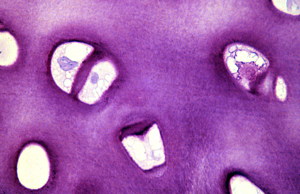  hyaline cartilage 