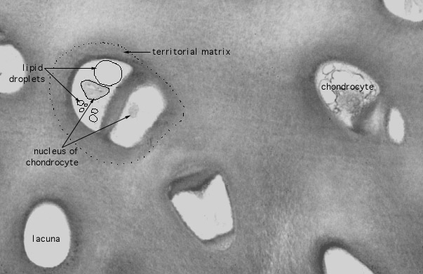  hyaline cartilage 