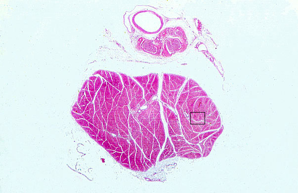  skeletal muscle fibers, transverse 