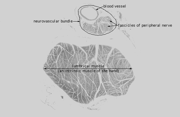  skeletal muscle, connective tissue investments, transverse 