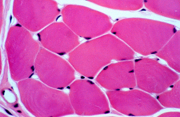 skeletal muscle fibers, transverse section