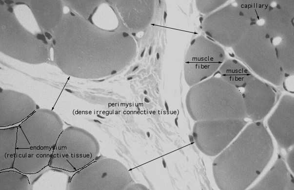  skeletal muscle, ensheathment, transverse 