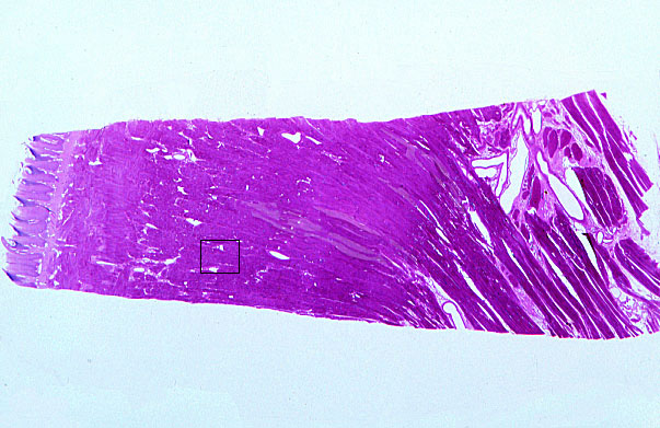  skeletal muscle types 