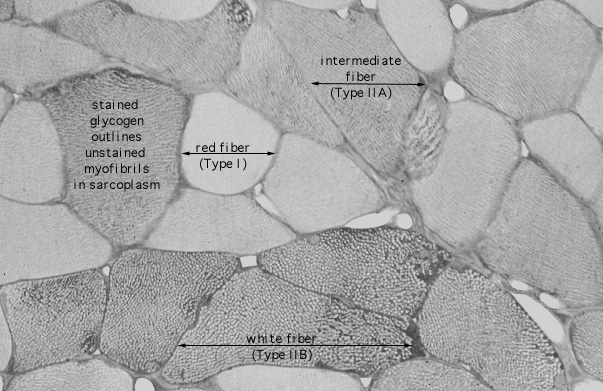  skeletal muscle types 