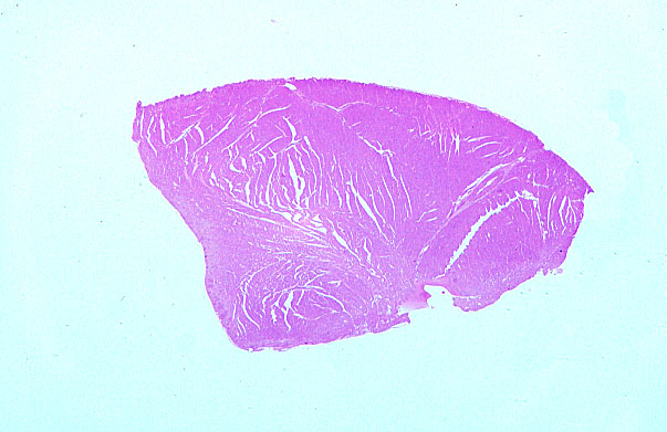  myocardium, cardiac conducting cells 