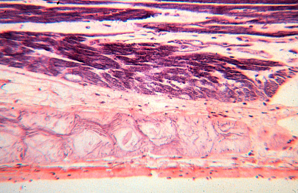  Purkinje cells 