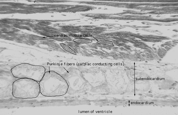 Purkinje cells 