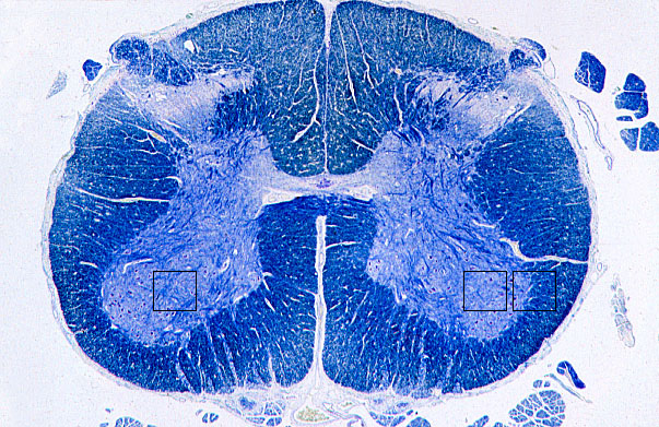  spinal cord 