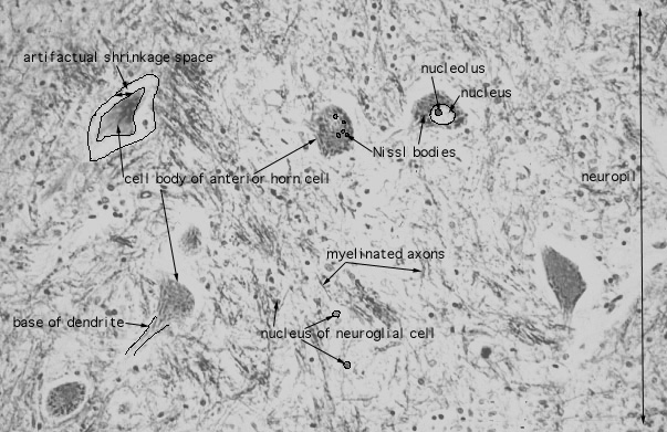 spinal cord, cell bodies of anterior horn cells 