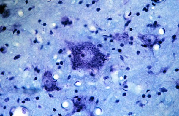  spinal cord, cell bodies of anterior horn cells 