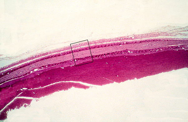  peripheral nerve, longitudinal 