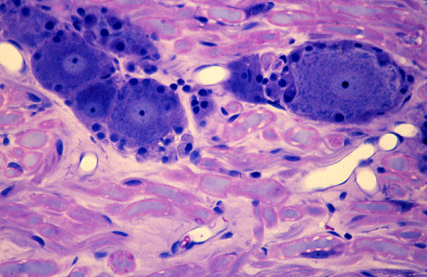  dorsal root ganglion, primary sensory neurons 