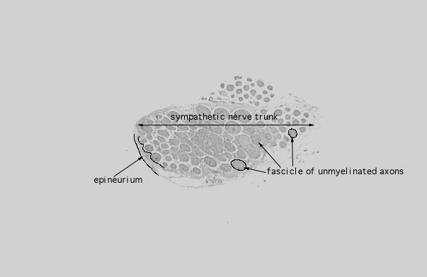  unmyelinated nerve 