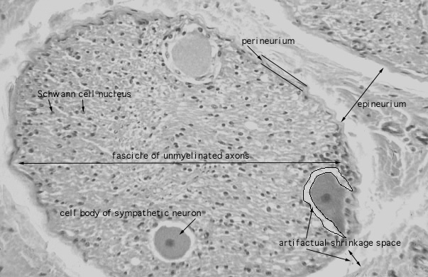  unmyelinated nerve 