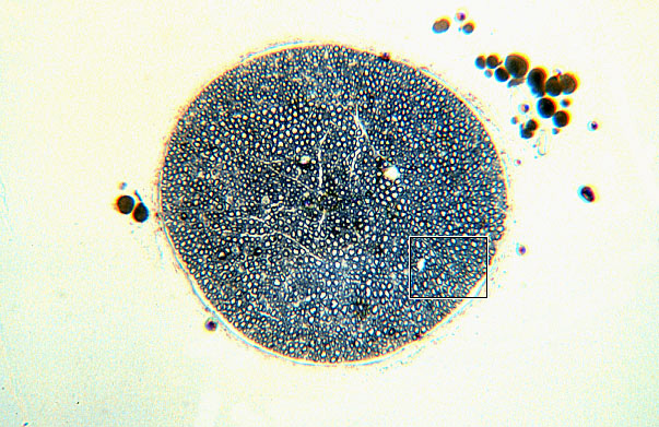 peripheral nerve, osmium fixed 