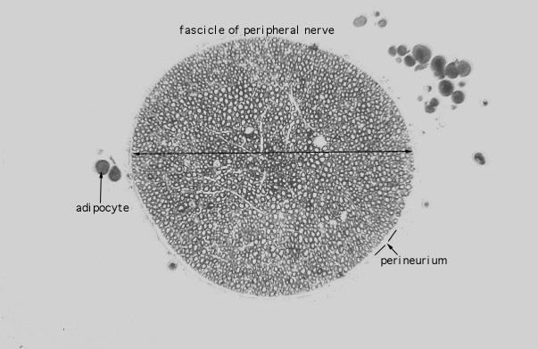  peripheral nerve, osmium fixed 